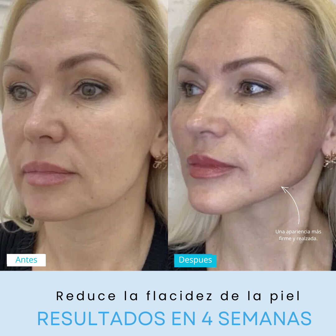 GLOWLIFT - Masajeador Facial